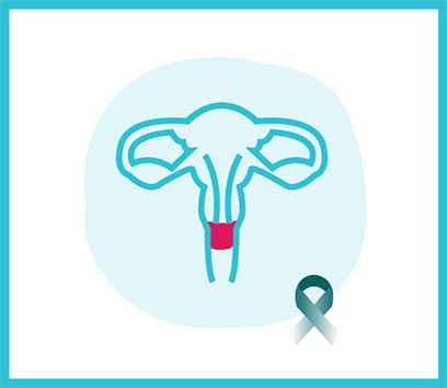 Cervical Cancer