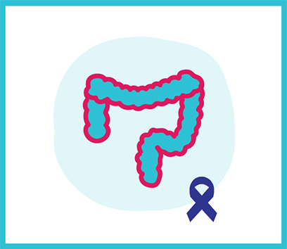 Colorectal Cancer