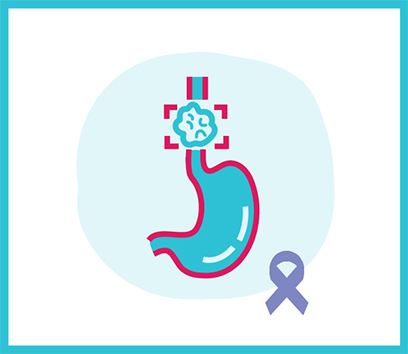 Esophageal Cancer